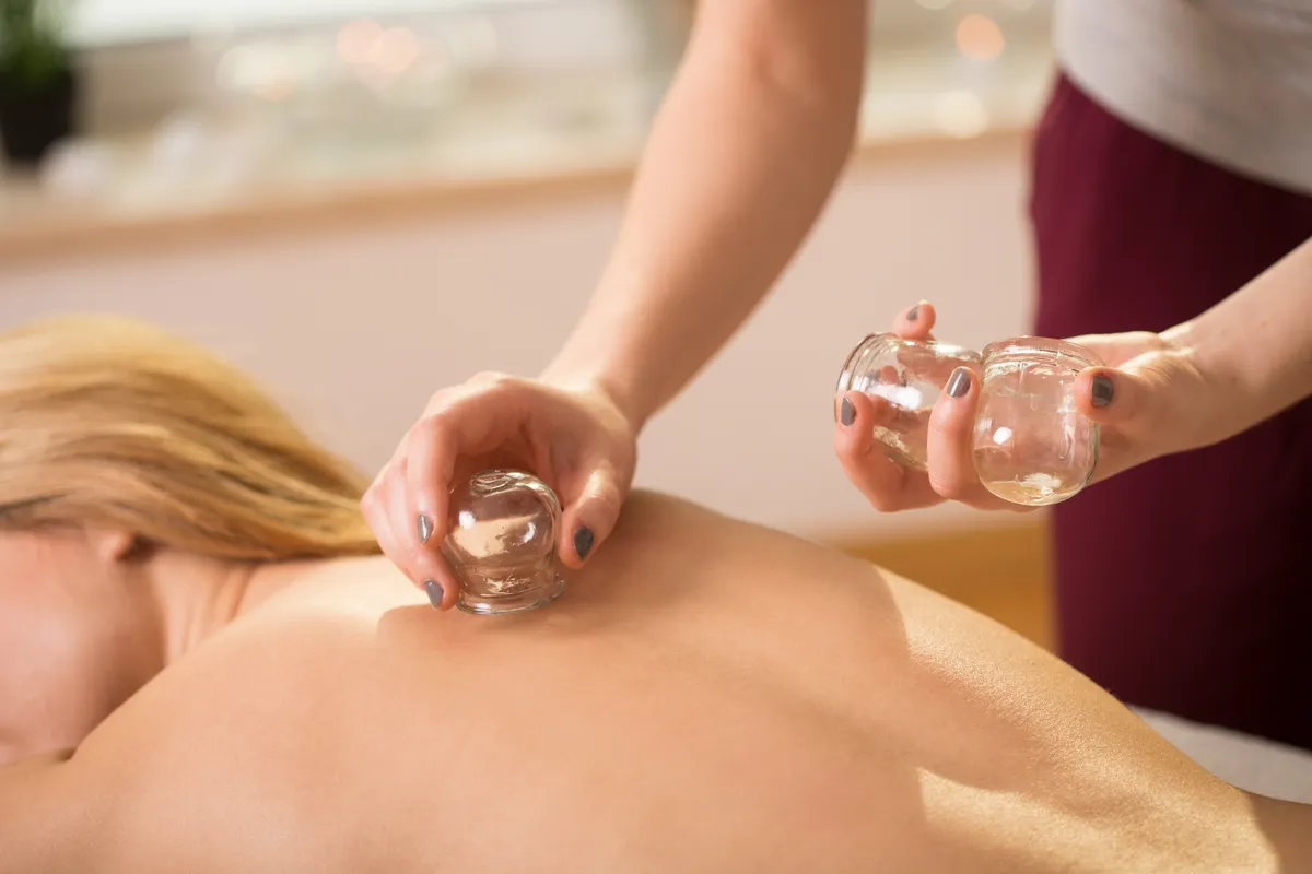 Young woman having cupping therapy on her back